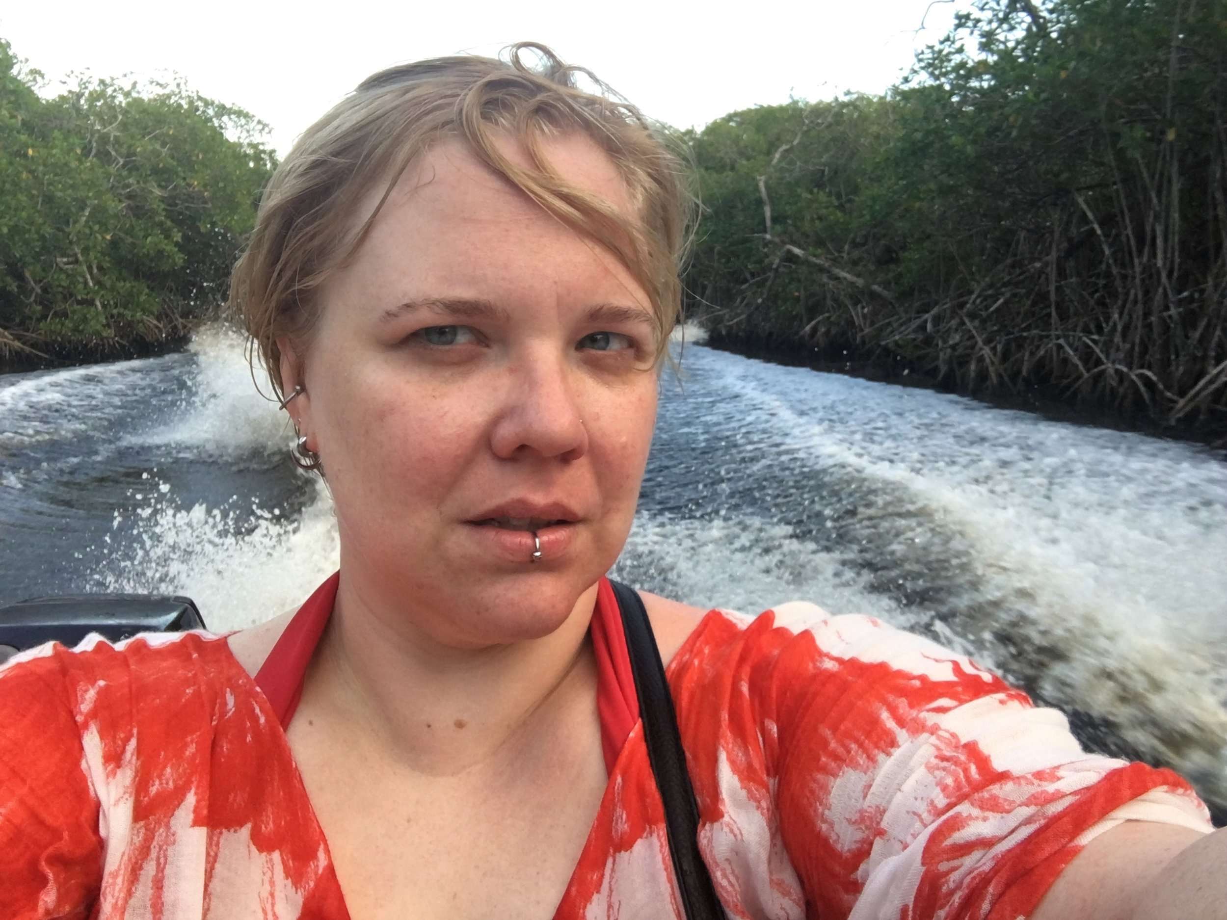 Injured In Belize - A Cautionary Tale